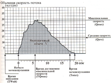 урофлоуметрия - график