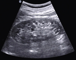 узи почек - фото