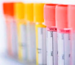 проба Реберга - фото