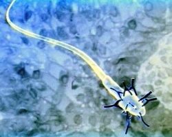 антиспермальные антитела - фото