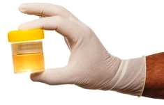 моча (урина) - фото