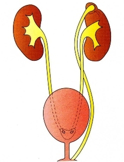 аномалии мочеточника