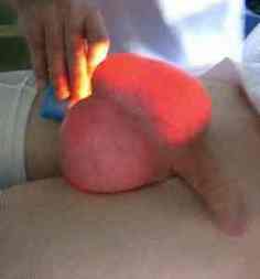 диафаноскопия