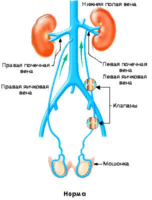 Нормальная яичковая вена - рисунок