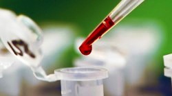 биохимический анализ крови - фото